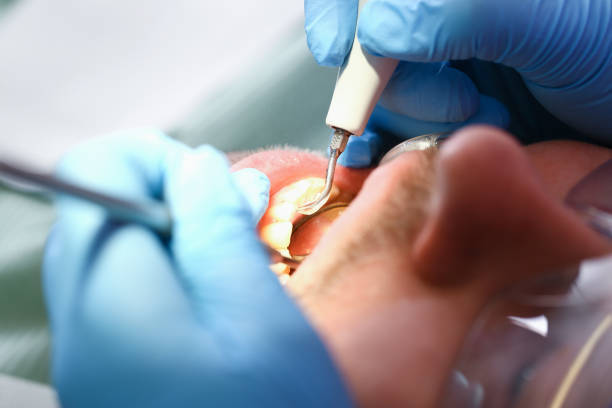 Best Urgent Care for Lost Fillings or Crowns in Turley, OK