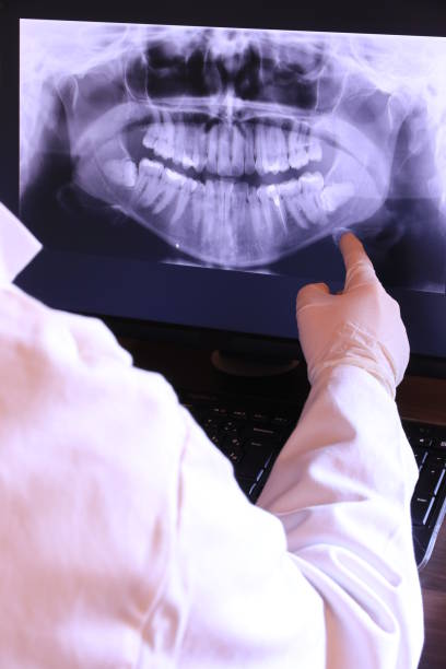 Best Emergency Wisdom Teeth Removal in Turley, OK
